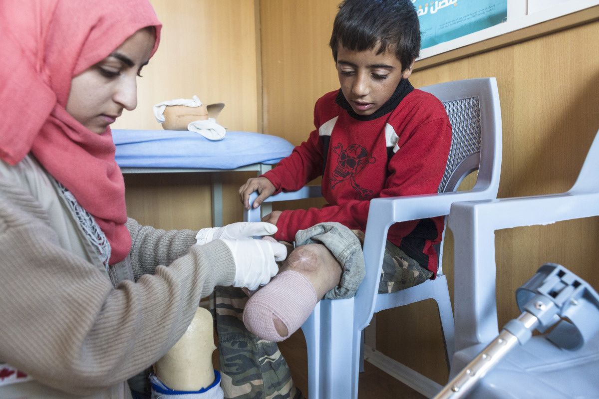 Un petit garçon amputé de la jambe gauche en-dessous du genou est examiné par une kinésithérapeute de Handicap International